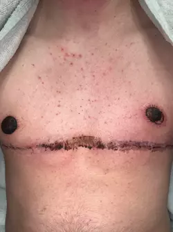 nipple-graph-concern-v0-320ll6m3ahre1.webp