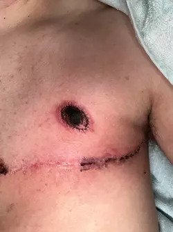 nipple-graph-concern-v0-pm78q6m3ahre1.webp