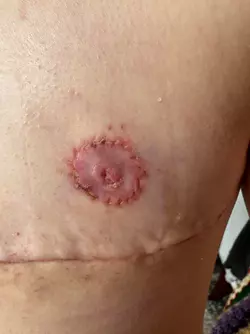 i-definitely-think-my-nipple-is-infected-v0-1g7w26przgse1.webp