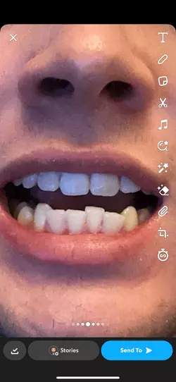 Clav Teeth 2.png