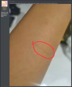 Self-Harm infographic.png