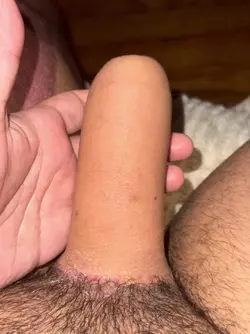 9-weeks-rff-post-op-penis-bonus-separatec-briefs-underwear-v0-sl1gk05goiue1.webp