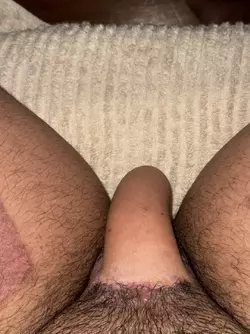 9-weeks-rff-post-op-penis-bonus-separatec-briefs-underwear-v0-oygyt52foiue1.webp