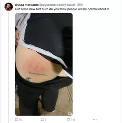 turf burn 01.webp