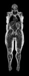 espree_whole_body_clinical_image-crop.jpg