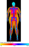 dexa-scan-week-1.jpg