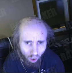 cyraxx-derpy-face.webp