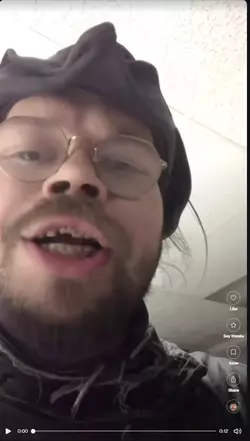 teeth update.webp