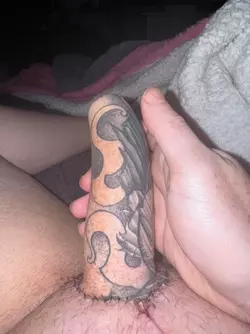 9-days-post-op-v0-ae0zzlx1p1ye1.webp