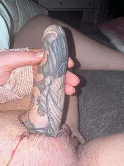 9-days-post-op-v0-7t2iemx1p1ye1.webp