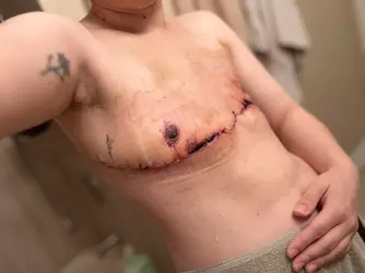 am-i-the-only-one-that-looks-like-this-post-op-v0-dc54rddx5iye1.webp