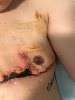 am-i-the-only-one-that-looks-like-this-post-op-v0-4b3f0edx5iye1.webp