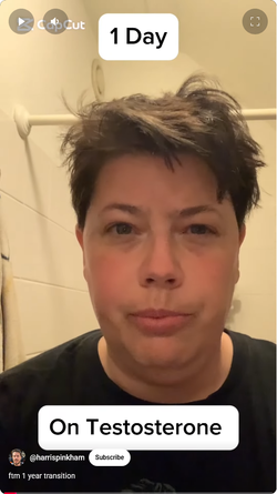Screenshot 2025-05-05 at 18-39-27 ftm 1 year transition - YouTube.webp
