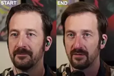 nose_enhance.webp