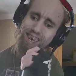 Raxx Teeth (2).webp