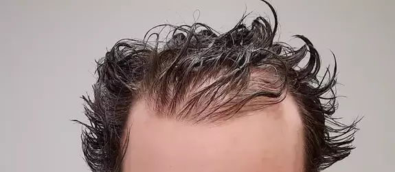1747110495360.webp