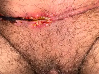 worried-about-incision-gory-photo-v0-27t24xskcw0f1.webp