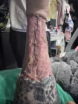 arm-graft-concerns-v0-r3vx7hxd000f1.webp