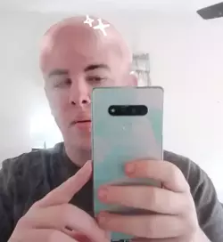 baldmojo