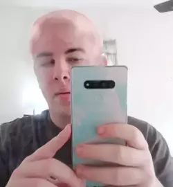 baldsmojo