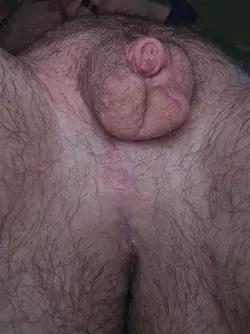 some-of-my-fav-pics-of-my-little-post-op-guy-v0-6tff4naaj82f1.webp