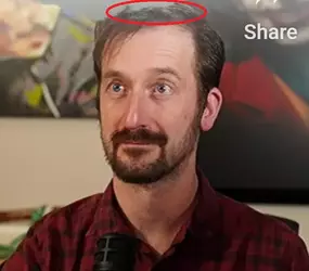 Nicholas - Hairline.webp