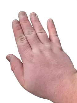 26 year old fat hand.webp