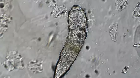 demodex-mite.webp