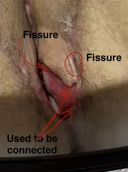 tw-graphic-major-tissue-death-and-recovery-v0-y30z9j20i44f1.webp