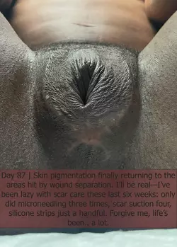 part-2-dr-kenan-celtik-crane-center-sf-post-op-photo-dump-v0-5l4juoh3ty3f1.webp