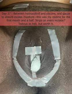 part-2-dr-kenan-celtik-crane-center-sf-post-op-photo-dump-v0-0uhnv2wrsy3f1.webp