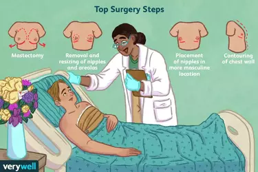 top-surgery-purpose-5094742_Final-260eabf2cf534d0ab0361659cc9bc79e.webp