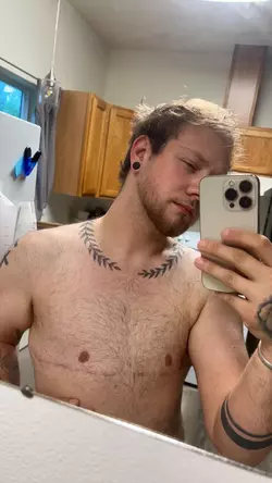 3-years-1-year-1-day-pre-op-v0-nwjz7mntui4f1.webp