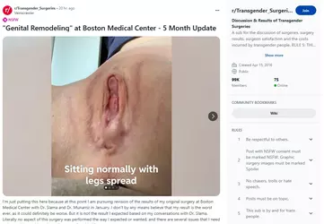 Veinscrawler02.webp