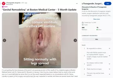 Veinscrawler03.webp