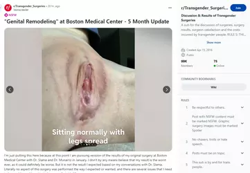 Veinscrawler04.webp