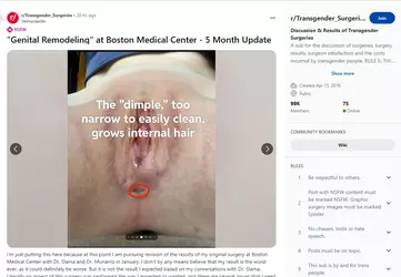 Veinscrawler08.webp