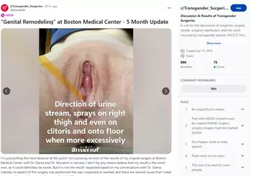 Veinscrawler09.webp