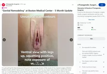 Veinscrawler11.webp