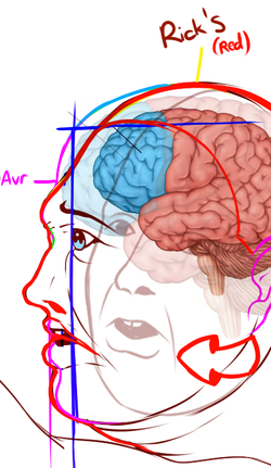 FFWBT brain.webp