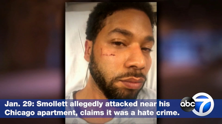 5363455_062519-wls-smollett-timeline-spoton-vid.webp