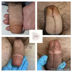 no-glandplasty-created-3d-glans-with-tattoo-v0-64myvoxvk85f1.webp