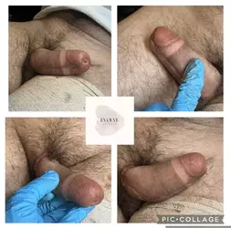 no-glandplasty-created-3d-glans-with-tattoo-v0-hvytmkxvk85f1.webp