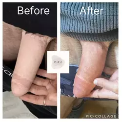 before-and-after-added-some-freckles-for-detail-on-penis-v0-ch6bhzkrtf3f1.webp