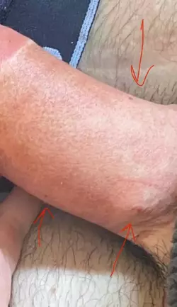 before-and-after-added-some-freckles-for-detail-on-penis-v0-l91tuykrtf3f1.webp