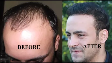 hair.webp