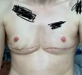 feeling-bad-still-have-boobs-v0-c3nmlyot2f9f1.webp