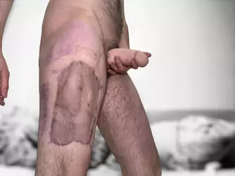 more-alt-post-op-pics-7-months-v0-r9u2kzfxgmce1.webp