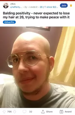 female tranny balding.webp