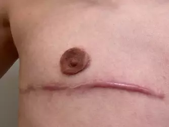 does-my-surgery-look-normal-v0-af8hvnkinybf1.webp